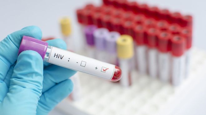 Human Testing for HIV Vaccine is Promising