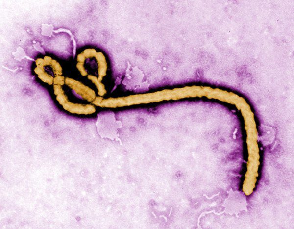 Ebola Is Now Considered Curable Thanks To New Treatments